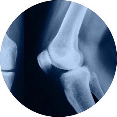 Рентген коленного сустава в Москве: цена, сделать снимок, адреса – СМ-Клиника